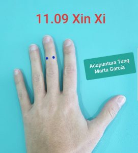 punto de acupuntura para dolor de rodilla, artrosis, degenerativo